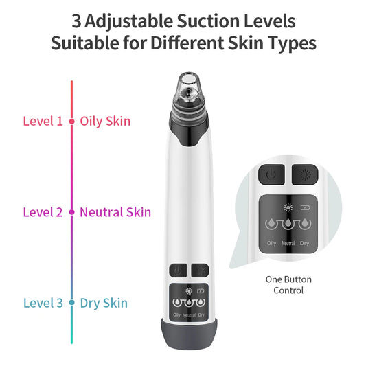 Blackhead Remover Vacuum with Hot Compress – 3-Level Suction, 4 Heads, USB Rechargeable