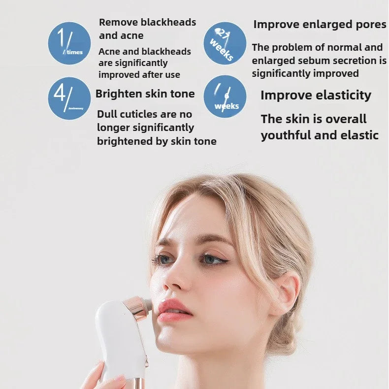Electric Blackhead Remover & Pore Vacuum – USB Rechargeable Water Cycle Cleanser