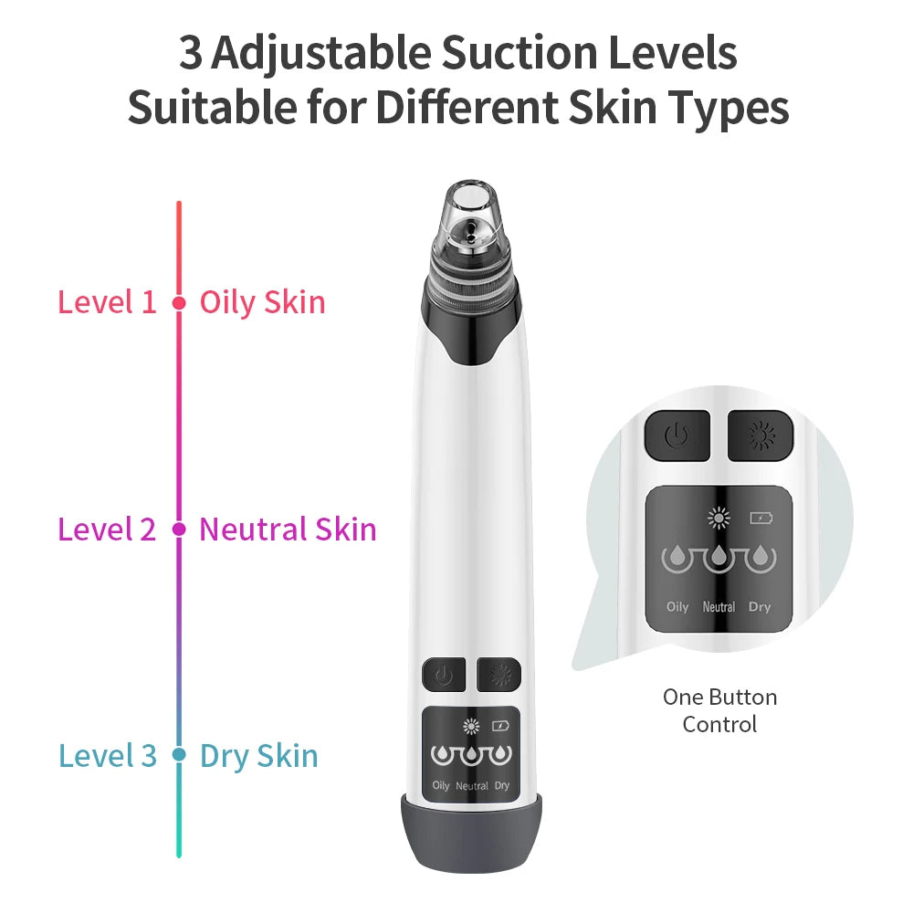Blackhead Remover Vacuum with Hot Compress – 3-Level Suction, 4 Heads, USB Rechargeable